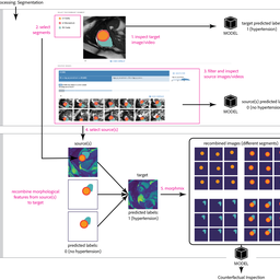 MiMICRI: Towards Domain-centered Counterfactual Explanations of Cardiovascular Image Classification Models