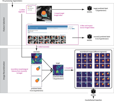 MiMICRI: Towards Domain-centered Counterfactual Explanations of Cardiovascular Image Classification Models